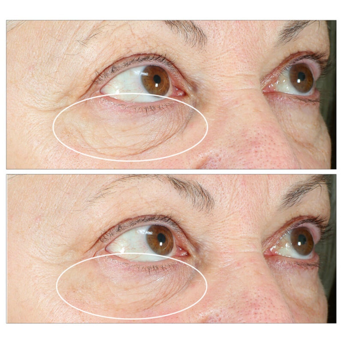 StriVectin I Hyperlift Eye Instant Eye Fix 10ml